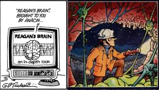 reigans-brain2